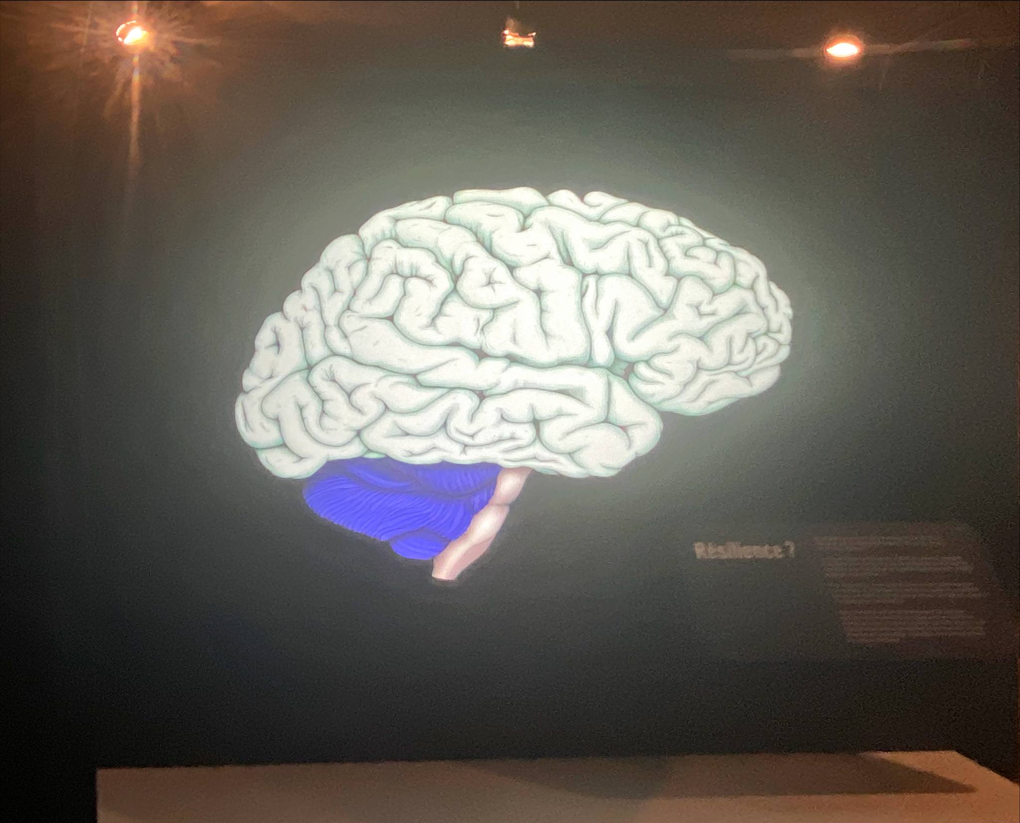 cerveau